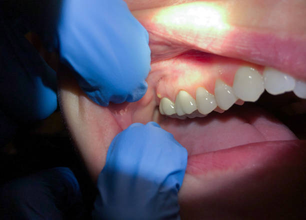 Best Emergency Cosmetic Dentistry (e.g., broken veneers) in Soda Springs, ID